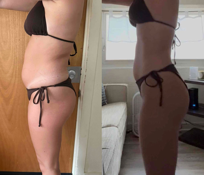 Transformation 1